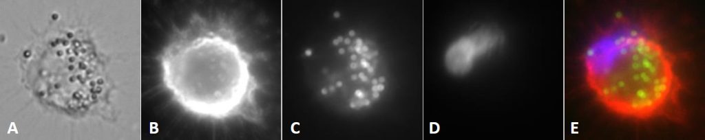 Mikroskopische Aufnahme einer einzelnen THP1-Zelle mit dem RCMIA-Mikroskop. A: Hellfeldaufnahme mit 1µm großen Beads, B: CD45-PE, C: Atto488-Beads, D: DAPI, E: Overlay der Fluoreszenzkanäle